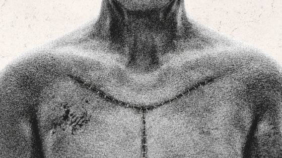 Autopsy Simulator